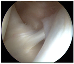 Uspešno izpeljano strokovno srečanje Ramenski sklep - Sodobni vidiki zdravljenja